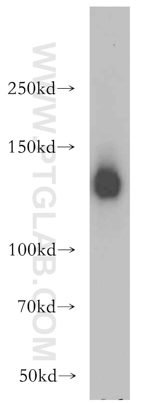 Western Blot (WB) analysis of L02 cells using SR140 Polyclonal antibody (21399-1-AP)