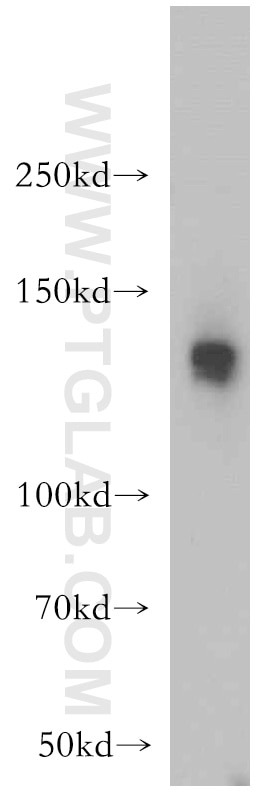 Western Blot (WB) analysis of mouse heart tissue using SR140 Polyclonal antibody (21399-1-AP)