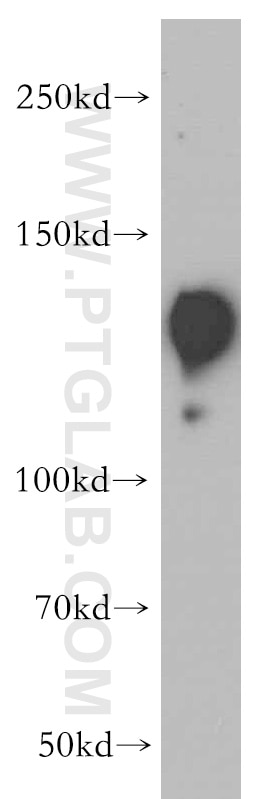 Western Blot (WB) analysis of HeLa cells using SR140 Polyclonal antibody (21399-1-AP)