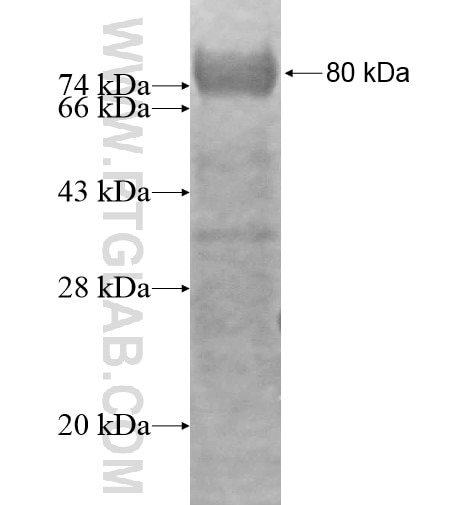 SR140 fusion protein Ag16093 SDS-PAGE