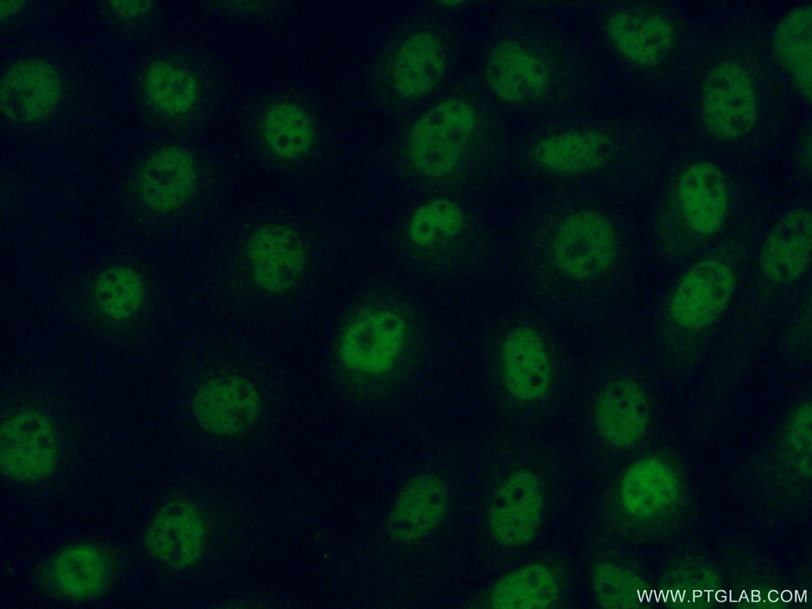 Immunofluorescence (IF) / fluorescent staining of A431 cells using SRA1 Polyclonal antibody (18699-1-AP)