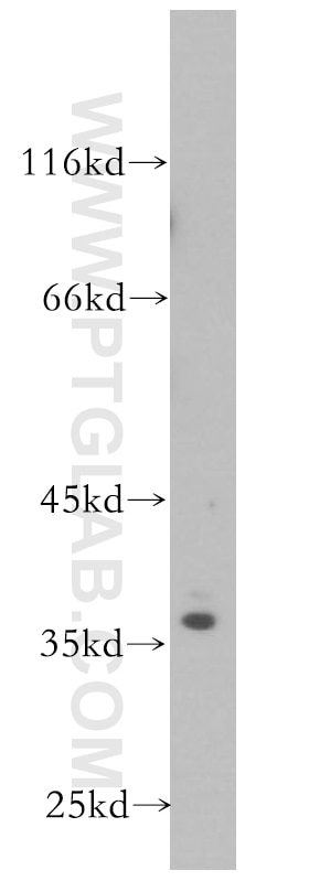 Western Blot (WB) analysis of A431 cells using SRA1 Polyclonal antibody (18699-1-AP)