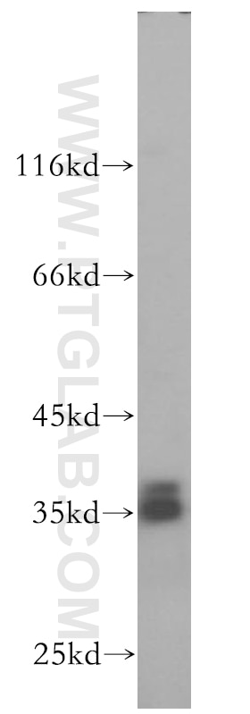 Western Blot (WB) analysis of MCF-7 cells using SRA1 Polyclonal antibody (18699-1-AP)