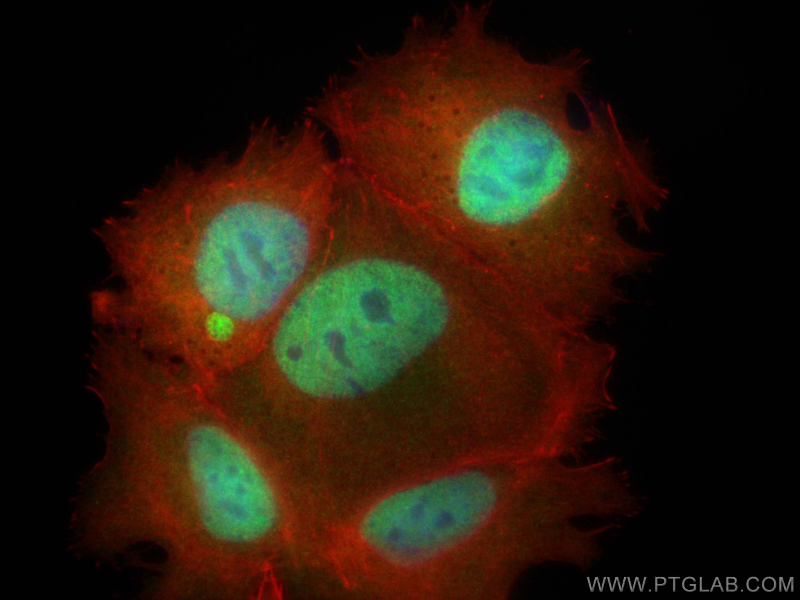 Immunofluorescence (IF) / fluorescent staining of MCF-7 cells using SRA1 Polyclonal antibody (24655-1-AP)