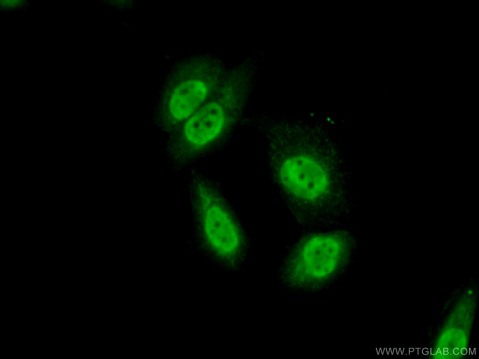 Immunofluorescence (IF) / fluorescent staining of MCF-7 cells using SRA1 Polyclonal antibody (24655-1-AP)