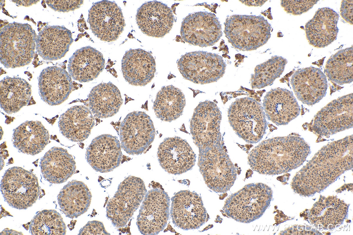 Immunohistochemistry (IHC) staining of mouse testis tissue using SRA1 Polyclonal antibody (24655-1-AP)