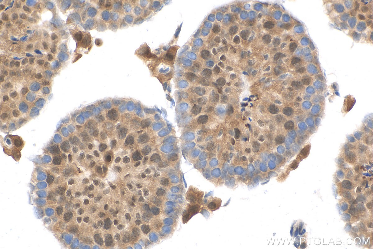 Immunohistochemistry (IHC) staining of mouse testis tissue using SRA1 Polyclonal antibody (24655-1-AP)