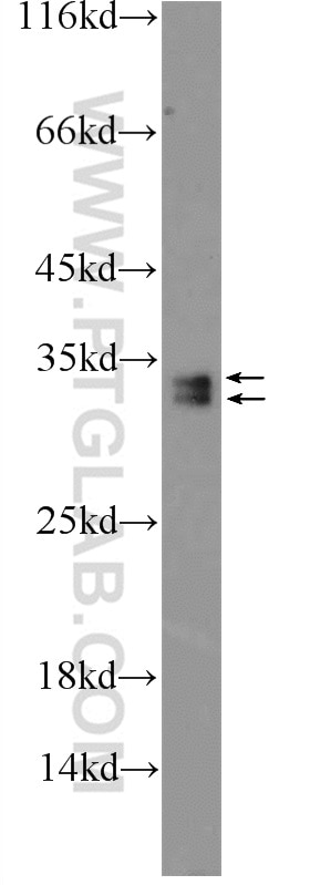 Western Blot (WB) analysis of A2780 cells using SRA1 Polyclonal antibody (24655-1-AP)