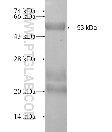 SRA1 fusion protein Ag20082 SDS-PAGE