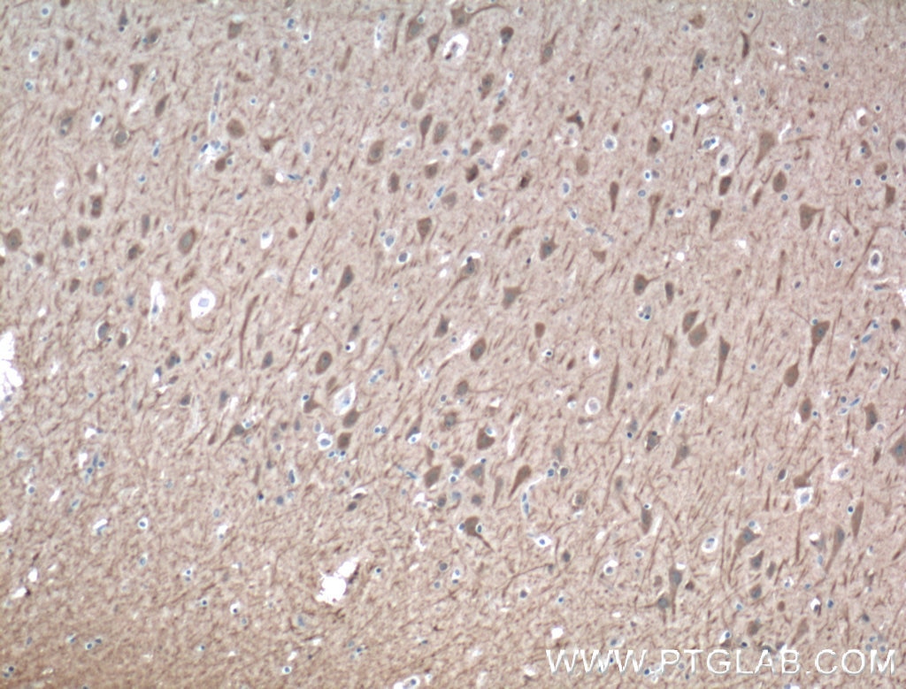 Immunohistochemistry (IHC) staining of human brain tissue using SRBD1 Polyclonal antibody (24931-1-AP)