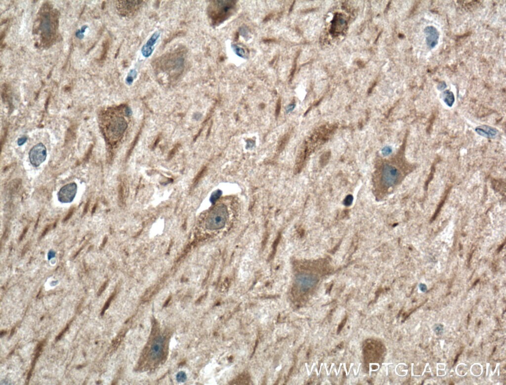 Immunohistochemistry (IHC) staining of human brain tissue using SRBD1 Polyclonal antibody (24931-1-AP)