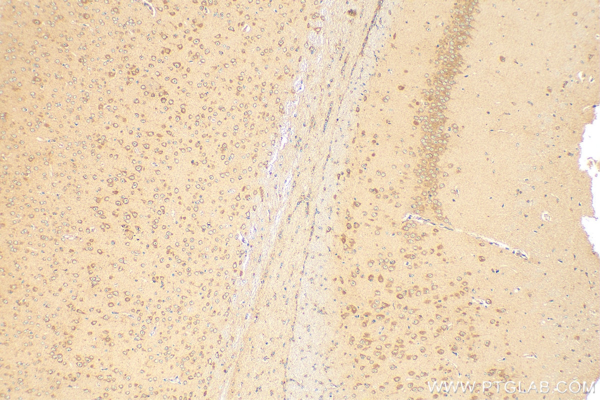 Immunohistochemistry (IHC) staining of mouse brain tissue using SRBD1 Polyclonal antibody (24931-1-AP)