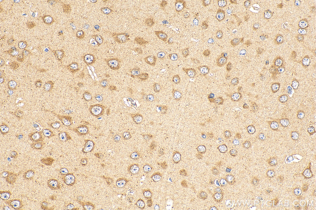 Immunohistochemistry (IHC) staining of mouse brain tissue using SRBD1 Polyclonal antibody (24931-1-AP)