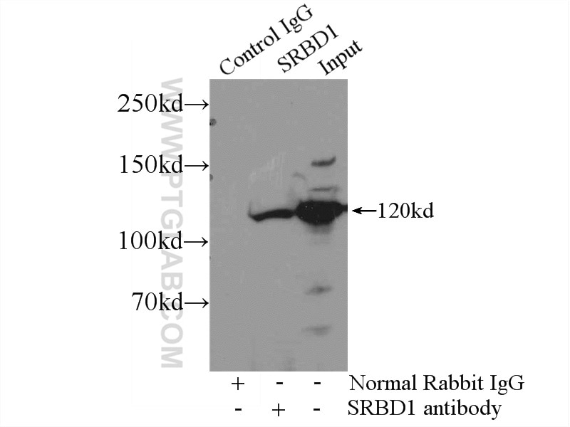Immunoprecipitation (IP) experiment of mouse brain tissue using SRBD1 Polyclonal antibody (24931-1-AP)