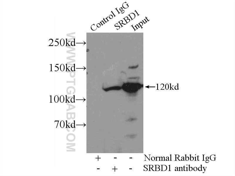 IP experiment of mouse brain using 24931-1-AP