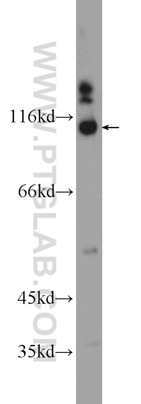 Western Blot (WB) analysis of mouse brain tissue using SRBD1 Polyclonal antibody (24931-1-AP)