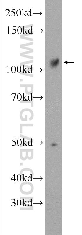 Western Blot (WB) analysis of mouse testis tissue using SRBD1 Polyclonal antibody (24931-1-AP)