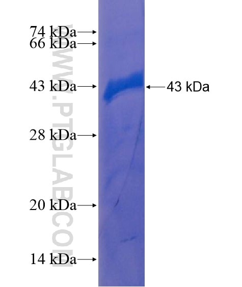 SRBD1 fusion protein Ag21661 SDS-PAGE