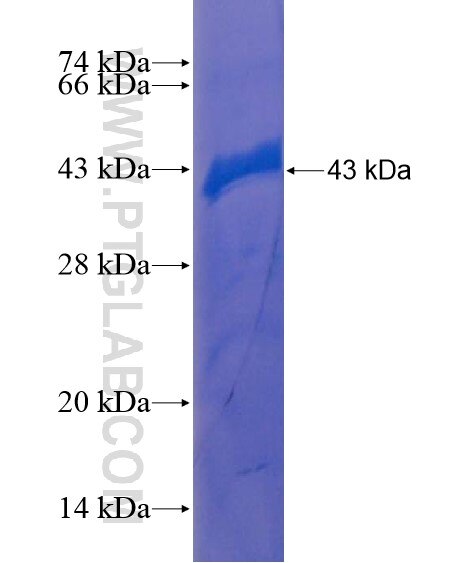 SRBD1 fusion protein Ag21661 SDS-PAGE