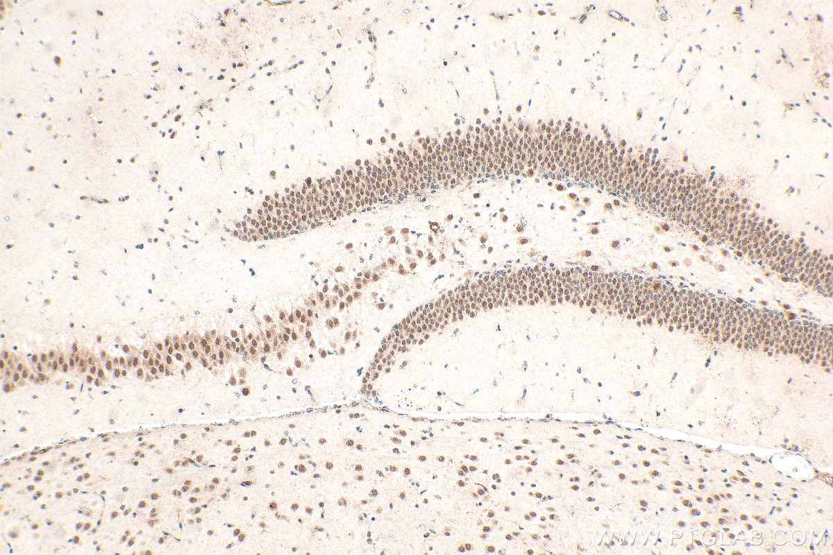 Immunohistochemical analysis of paraffin-embedded mouse brain tissue slide using 21952-1-AP (NCOA1/SRC-1 antibody) at dilution of 1:400 (under 10x lens). Heat mediated antigen retrieval with Tris-EDTA buffer (pH 9.0). Immunohistochemistry (IHC) staining of mouse brain tissue using NCOA1/SRC-1 Polyclonal antibody (21952-1-AP)
