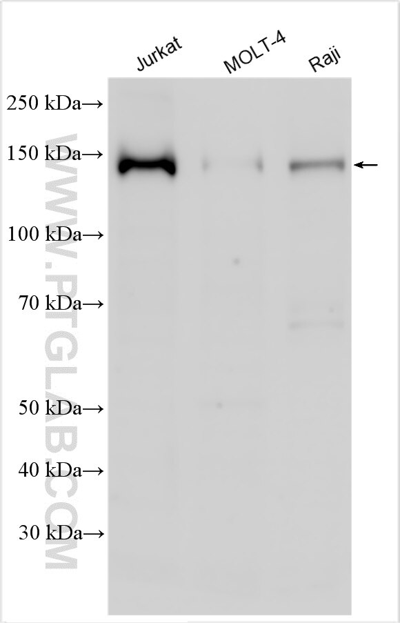 Western Blot (WB) analysis of various lysates using NCOA1/SRC-1 Polyclonal antibody (21952-1-AP)