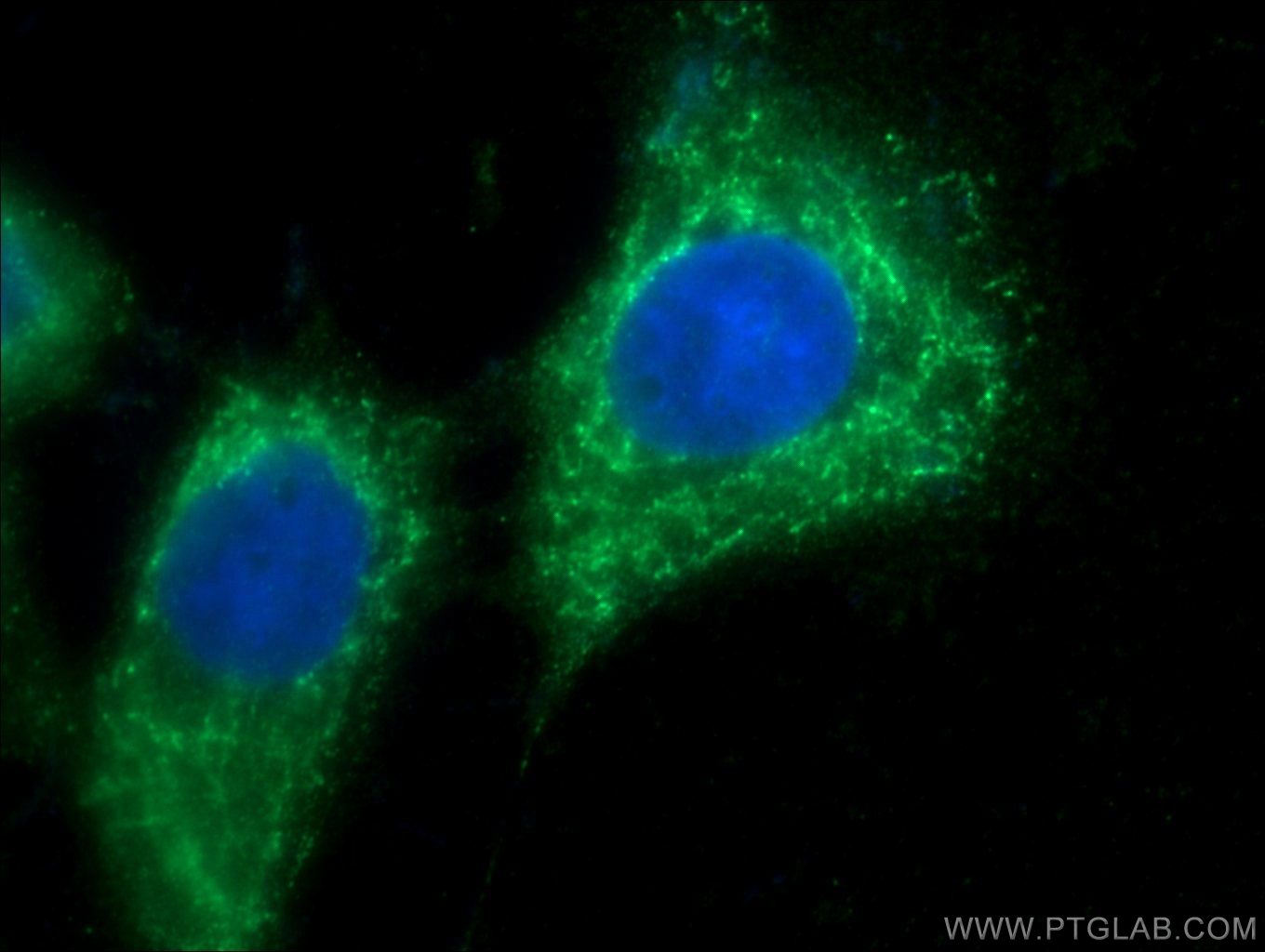 Immunofluorescence (IF) / fluorescent staining of A431 cells using c-SRC Polyclonal antibody (11097-1-AP)