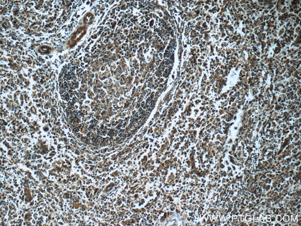 Immunohistochemistry (IHC) staining of human spleen tissue using c-SRC Polyclonal antibody (11097-1-AP)