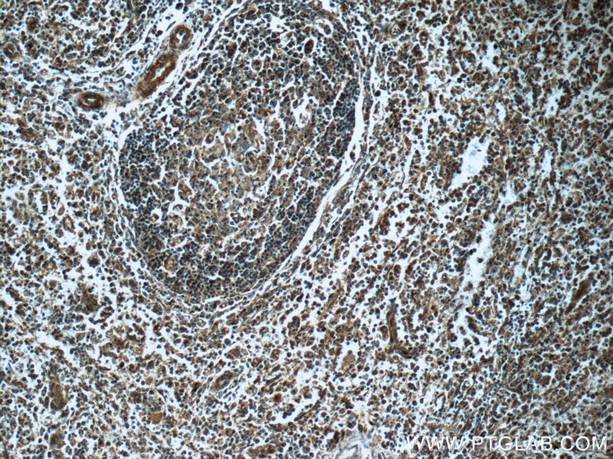 IHC staining of human spleen using 11097-1-AP