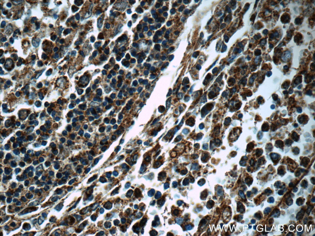Immunohistochemistry (IHC) staining of human spleen tissue using c-SRC Polyclonal antibody (11097-1-AP)