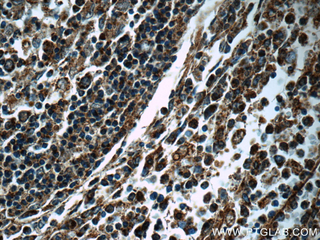 IHC staining of human spleen using 11097-1-AP