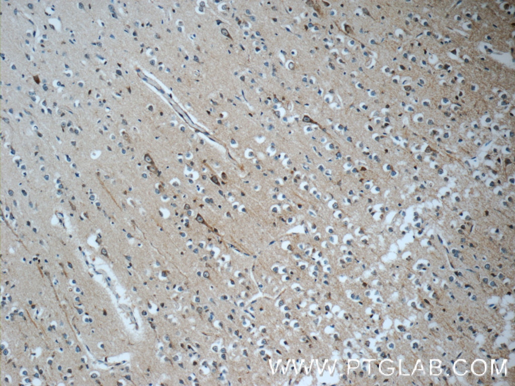 Immunohistochemistry (IHC) staining of human brain tissue using c-SRC Polyclonal antibody (11097-1-AP)
