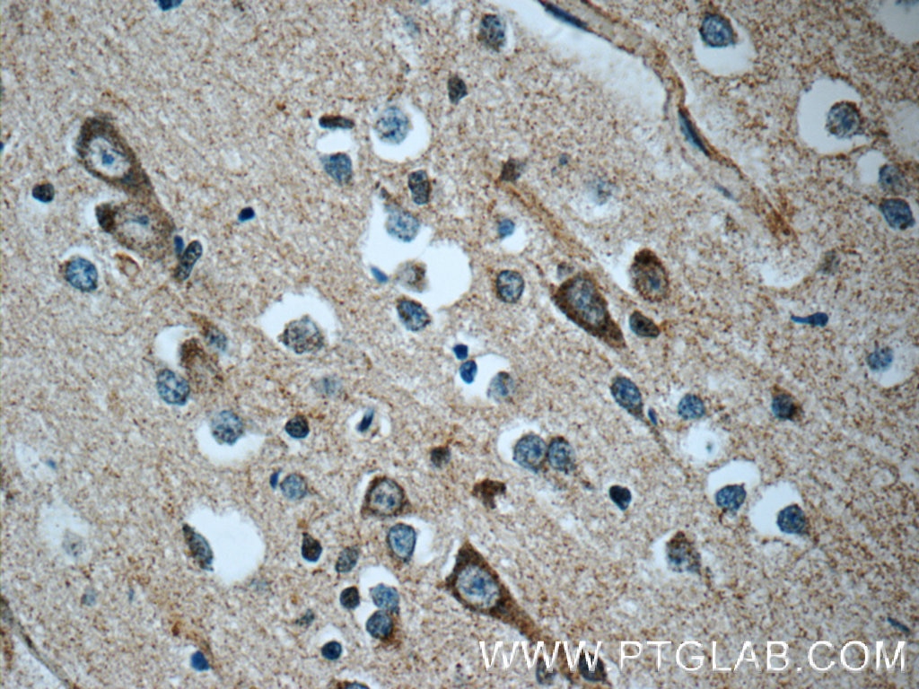 IHC staining of human brain using 11097-1-AP