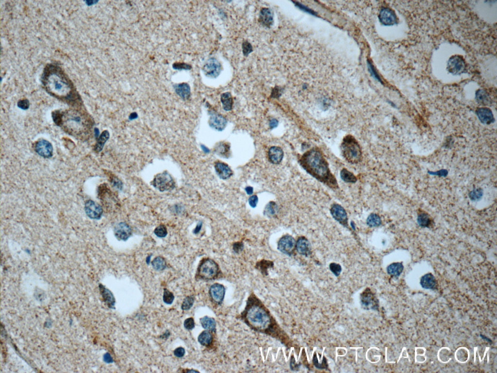 Immunohistochemistry (IHC) staining of human brain tissue using c-SRC Polyclonal antibody (11097-1-AP)