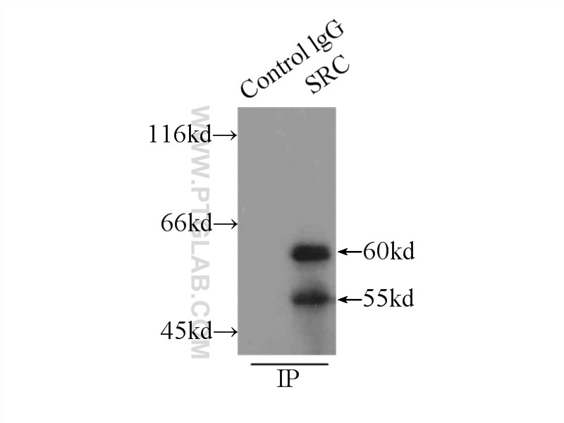 Immunoprecipitation (IP) experiment of SH-SY5Y cells using c-SRC Polyclonal antibody (11097-1-AP)
