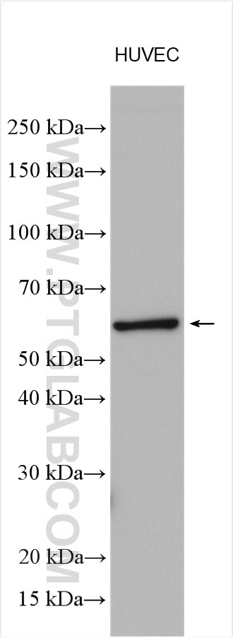 Western Blot (WB) analysis of various lysates using c-SRC Polyclonal antibody (11097-1-AP)
