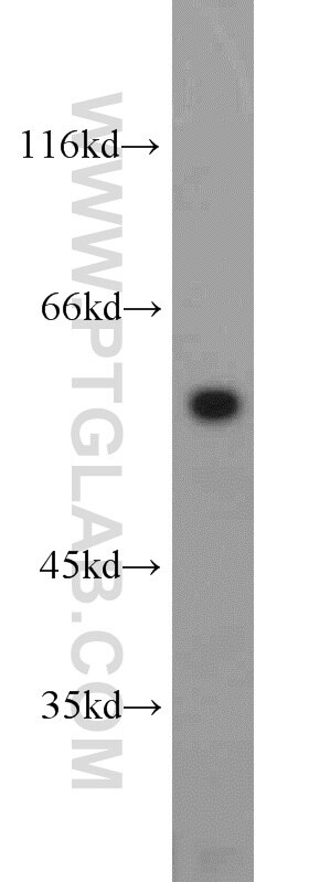 Western Blot (WB) analysis of mouse brain tissue using c-SRC Polyclonal antibody (11097-1-AP)