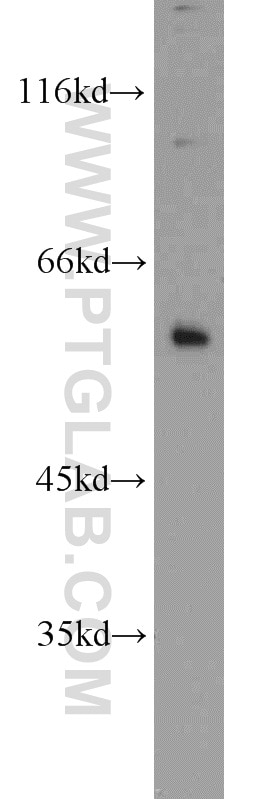 Western Blot (WB) analysis of COLO 320 cells using c-SRC Polyclonal antibody (11097-1-AP)
