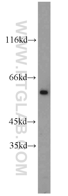 Western Blot (WB) analysis of Jurkat cells using c-SRC Polyclonal antibody (11097-1-AP)