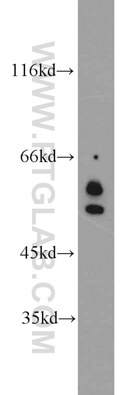 Western Blot (WB) analysis of A431 cells using c-SRC Polyclonal antibody (11097-1-AP)
