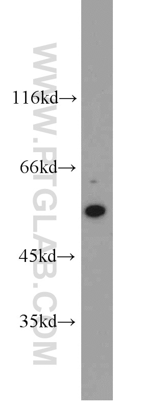 Western Blot (WB) analysis of CHO cells using c-SRC Polyclonal antibody (11097-1-AP)