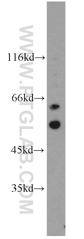 Western Blot (WB) analysis of SH-SY5Y cells using c-SRC Polyclonal antibody (11097-1-AP)