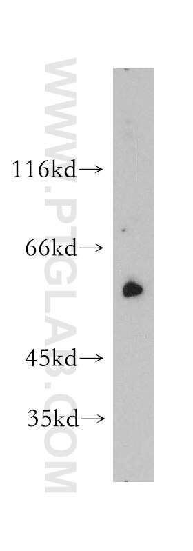 Western Blot (WB) analysis of A431 cells using c-SRC Polyclonal antibody (11097-1-AP)