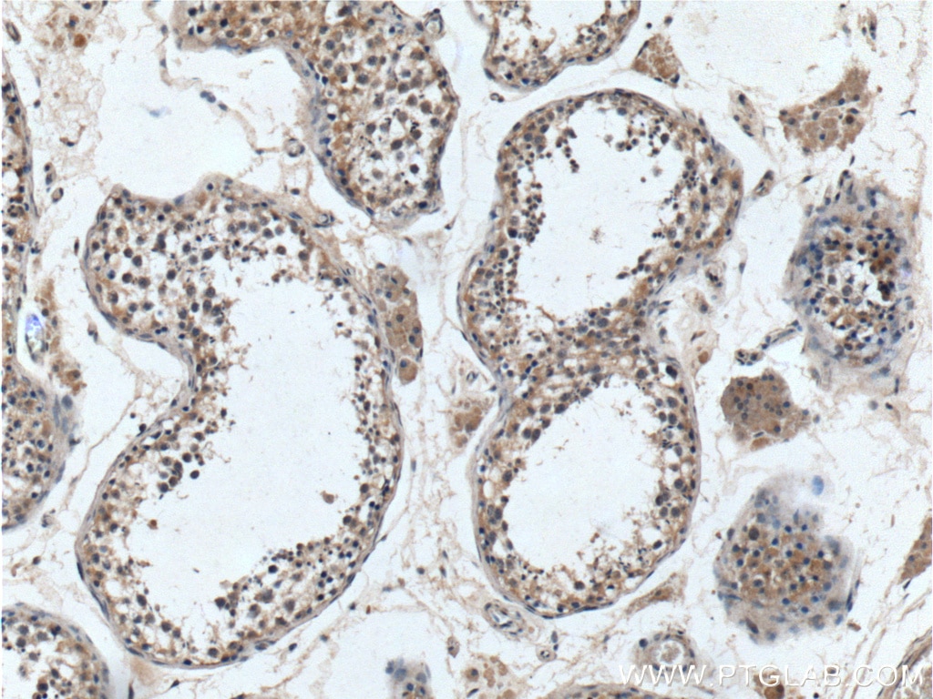 Immunohistochemistry (IHC) staining of human testis tissue using SRD5A1 Polyclonal antibody (26001-1-AP)