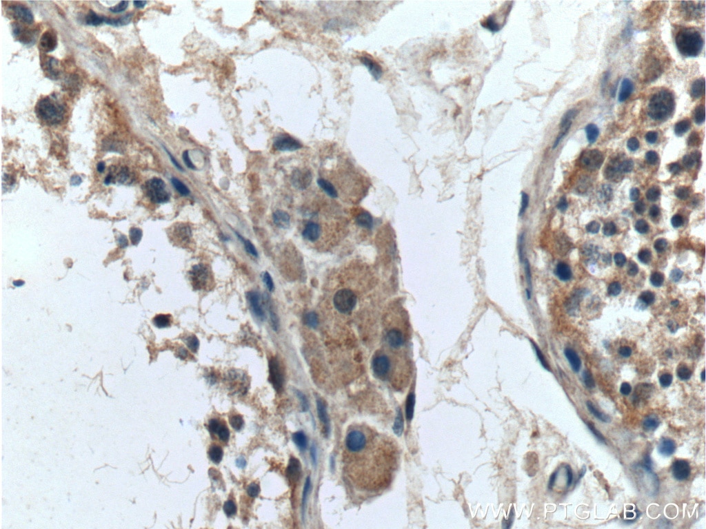 Immunohistochemistry (IHC) staining of human testis tissue using SRD5A1 Polyclonal antibody (26001-1-AP)