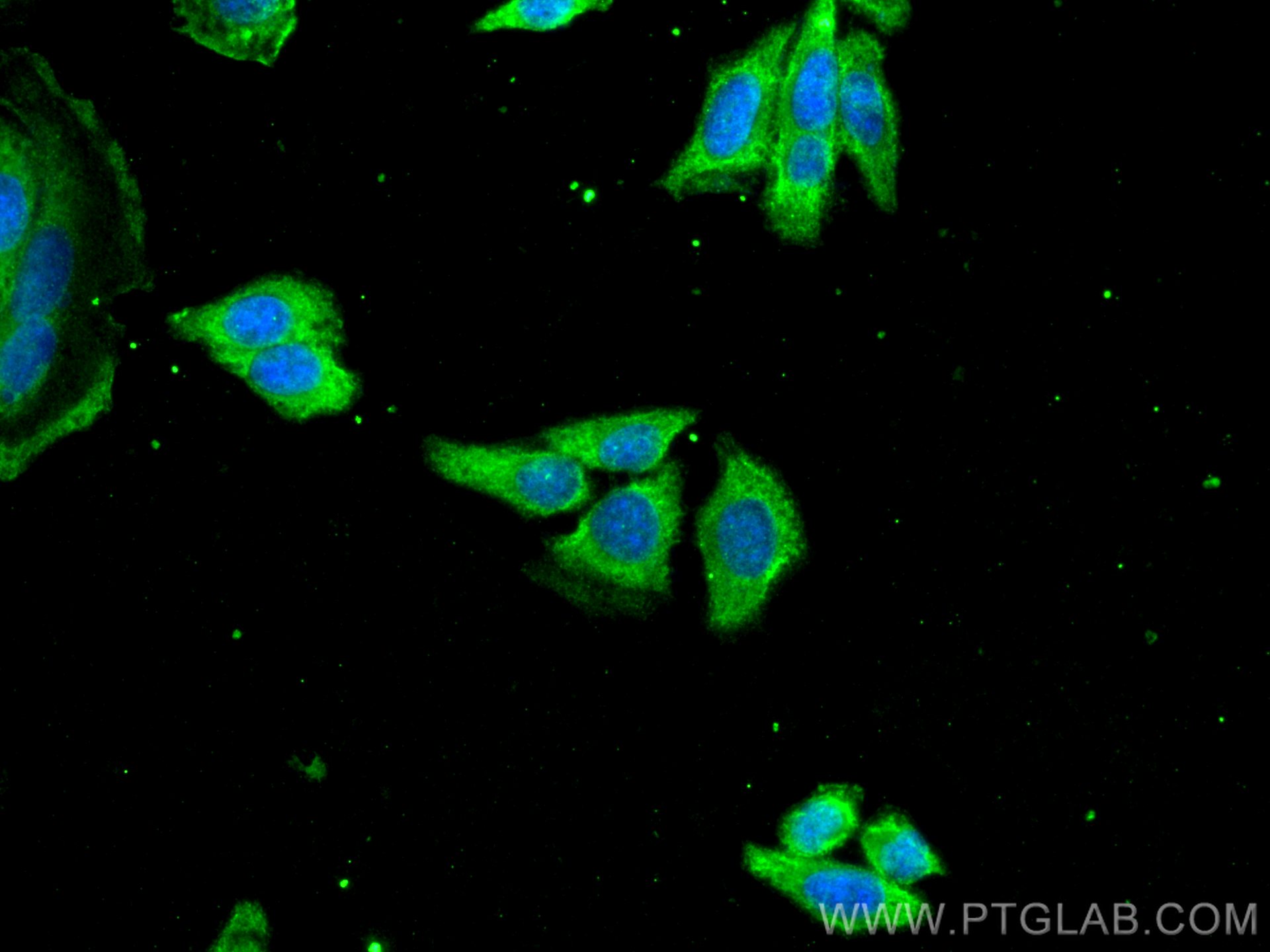 Immunofluorescence (IF) / fluorescent staining of HEPG2 cells using SRD5A1 Monoclonal antibody (66329-1-Ig)