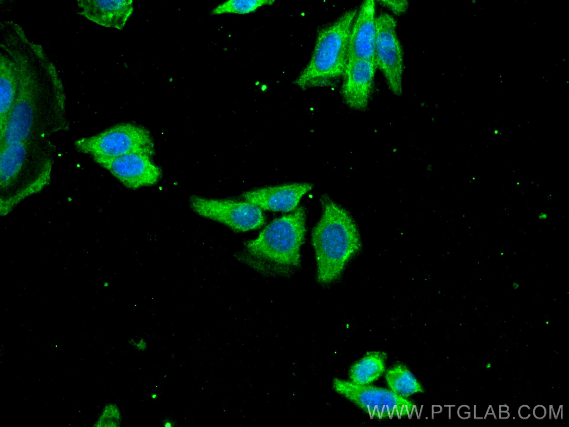 IF Staining of HEPG2 using 66329-1-Ig