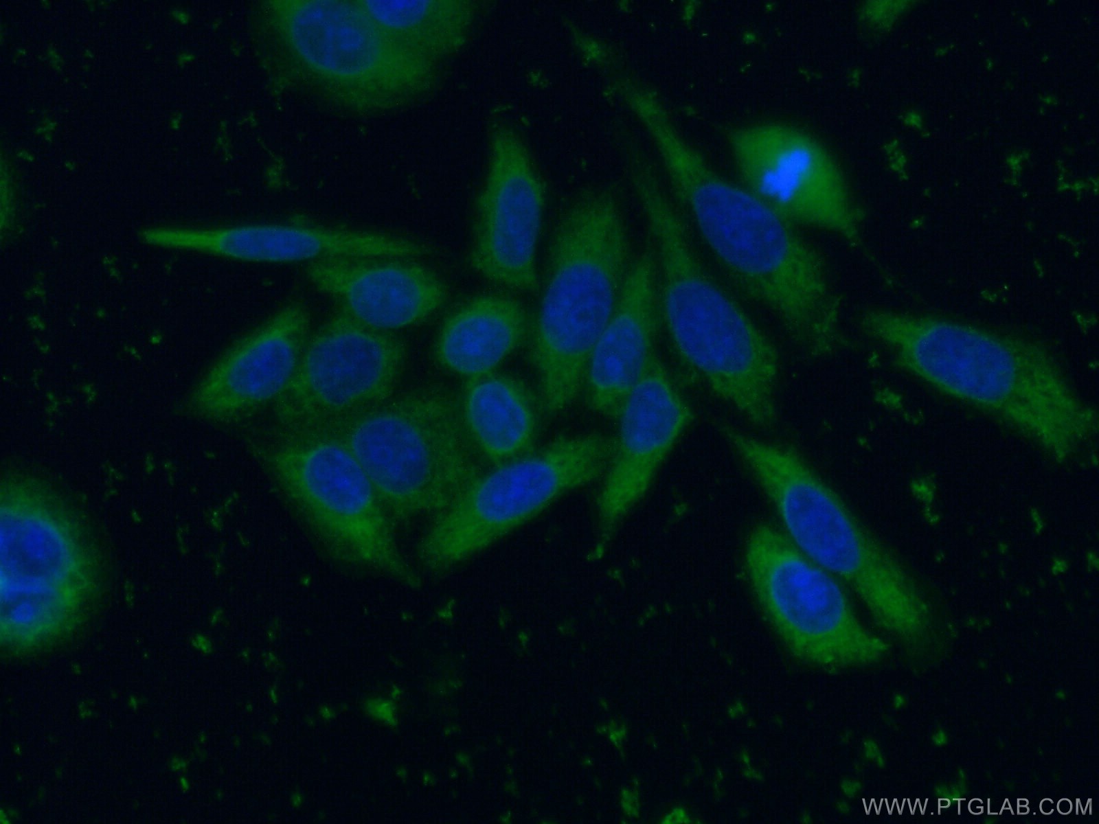 Immunofluorescence (IF) / fluorescent staining of HeLa cells using SRD5A1 Monoclonal antibody (66329-1-Ig)