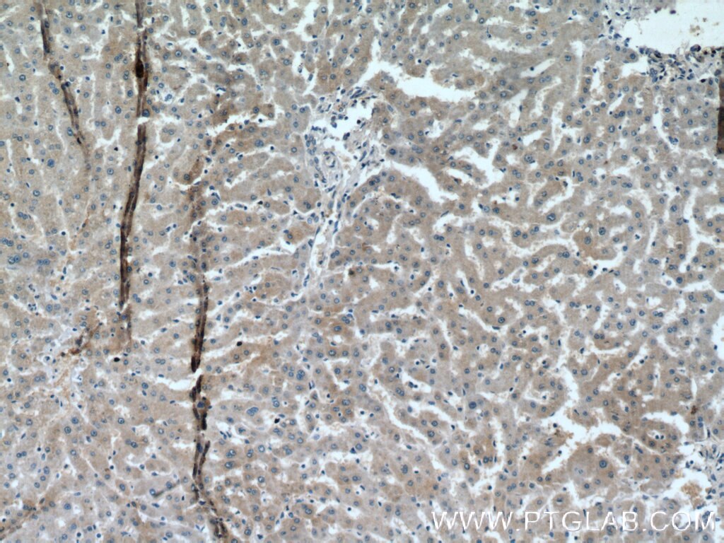 Immunohistochemistry (IHC) staining of human liver tissue using SRD5A1 Monoclonal antibody (66329-1-Ig)