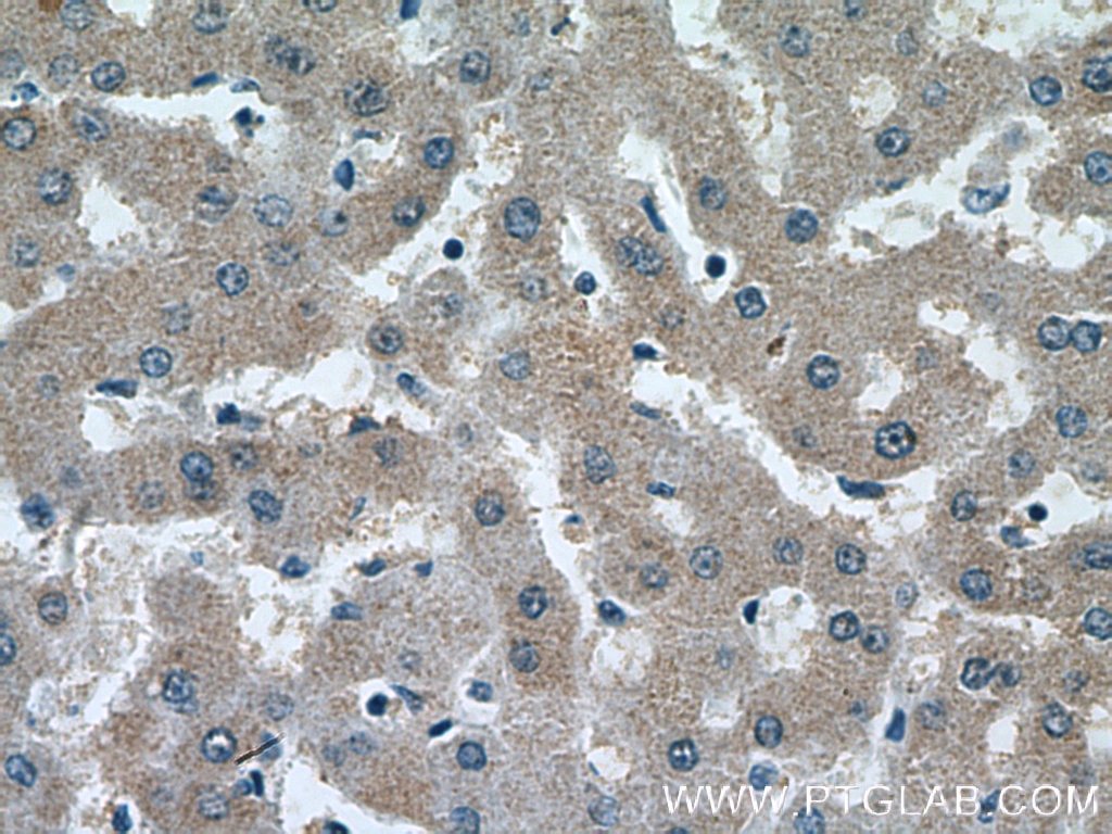 Immunohistochemistry (IHC) staining of human liver tissue using SRD5A1 Monoclonal antibody (66329-1-Ig)