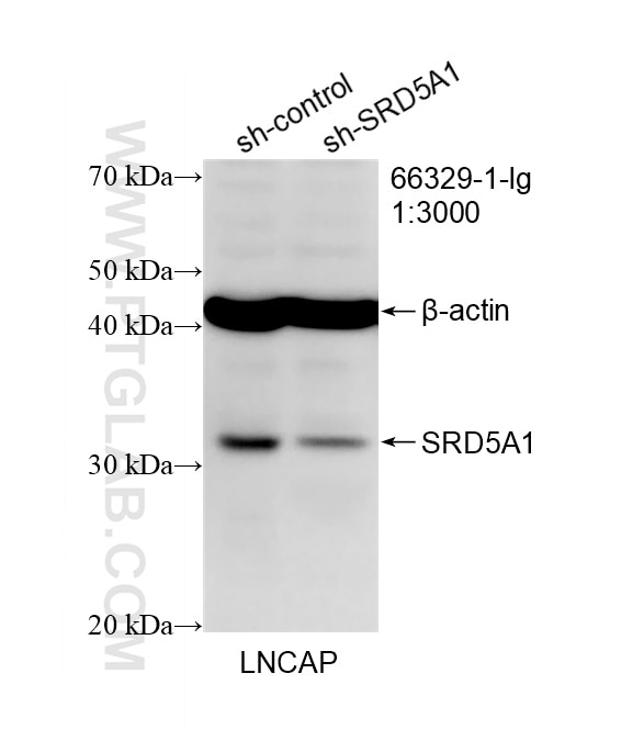 WB result of SRD5A1 antibody (66329-1-Ig; 1:3000; incubated at room temperature for 1.5 hours) with sh-Control and sh-SRD5A1 transfected LNCaP cells. Western Blot (WB) analysis of LNCaP cells using SRD5A1 Monoclonal antibody (66329-1-Ig)